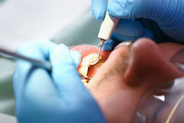 Best Emergency Denture Repair in Boiling Springs, NC