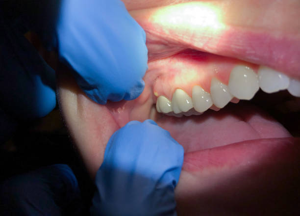 Best Pediatric Emergency Dentist in Boiling Springs, NC